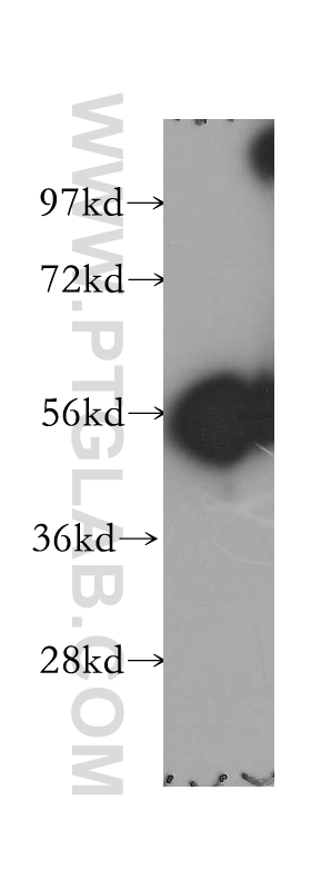 WB analysis of human lung using 12426-1-AP