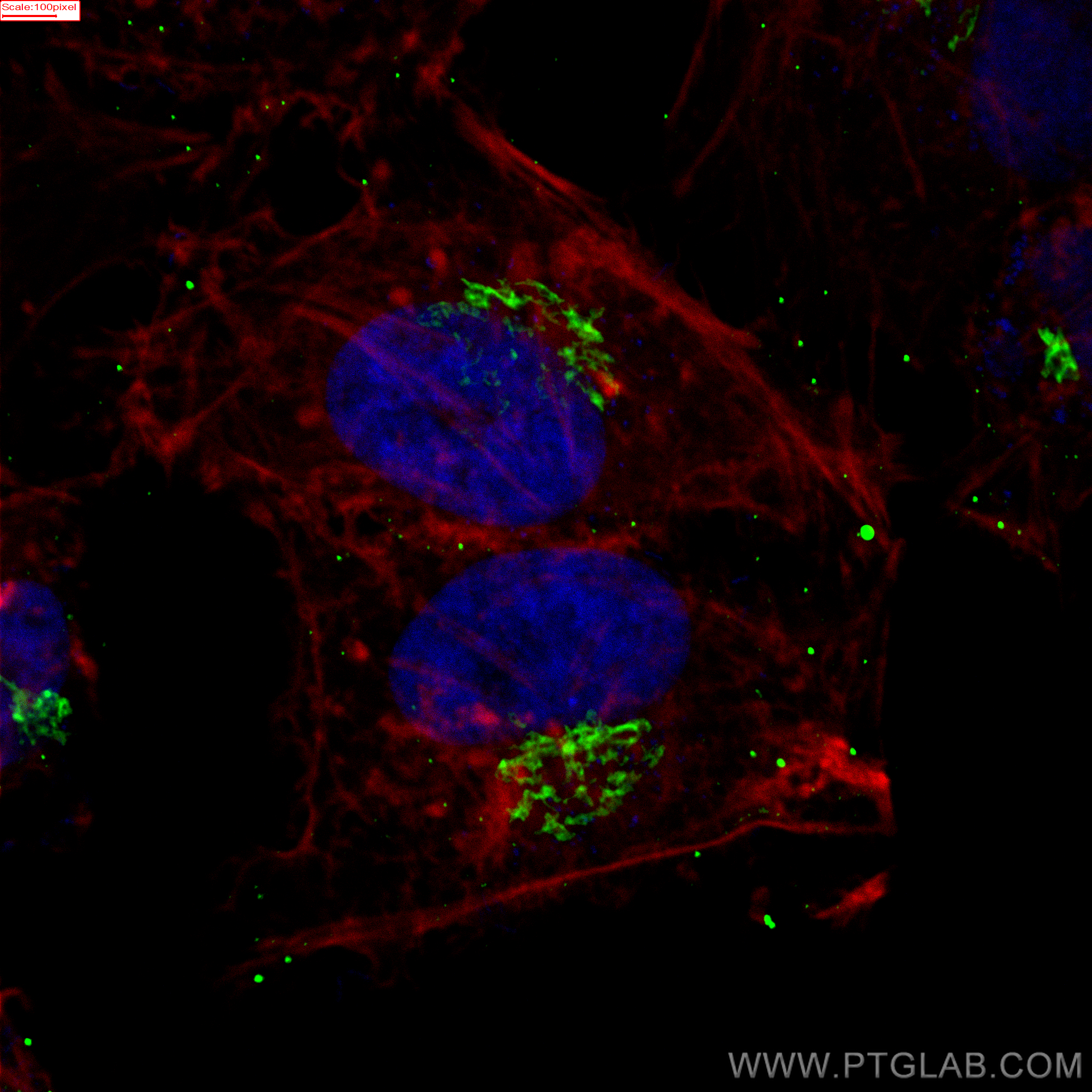 IF Staining of HeLa using 66662-1-Ig