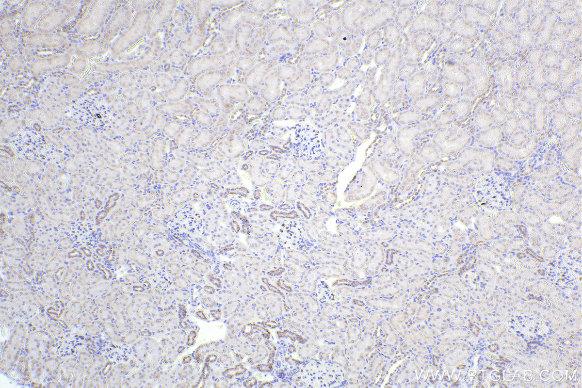 IHC staining of rat kidney using 82705-8-RR