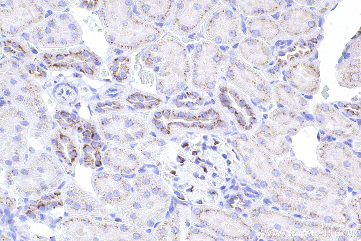 IHC staining of rat kidney using 82705-8-RR