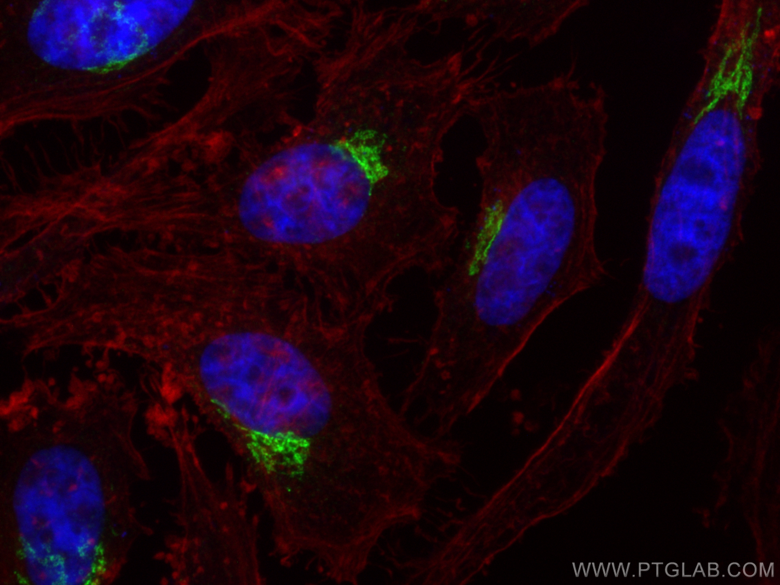 IF Staining of HeLa using 26456-1-AP