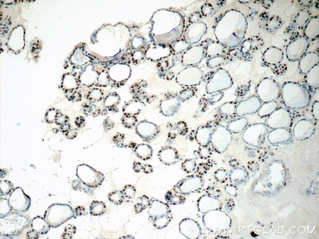 IHC staining of human thyroid using 15575-1-AP