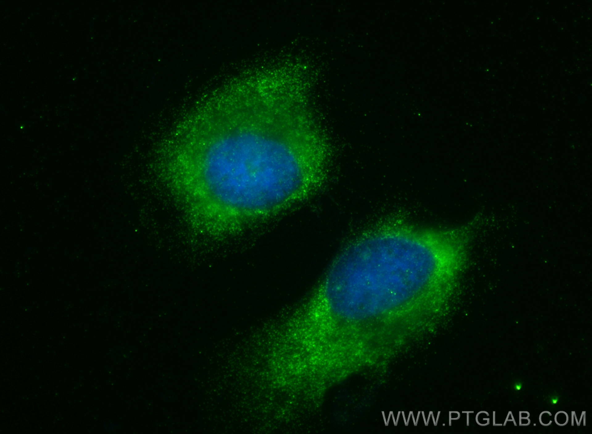 IF Staining of HeLa using 15442-1-AP