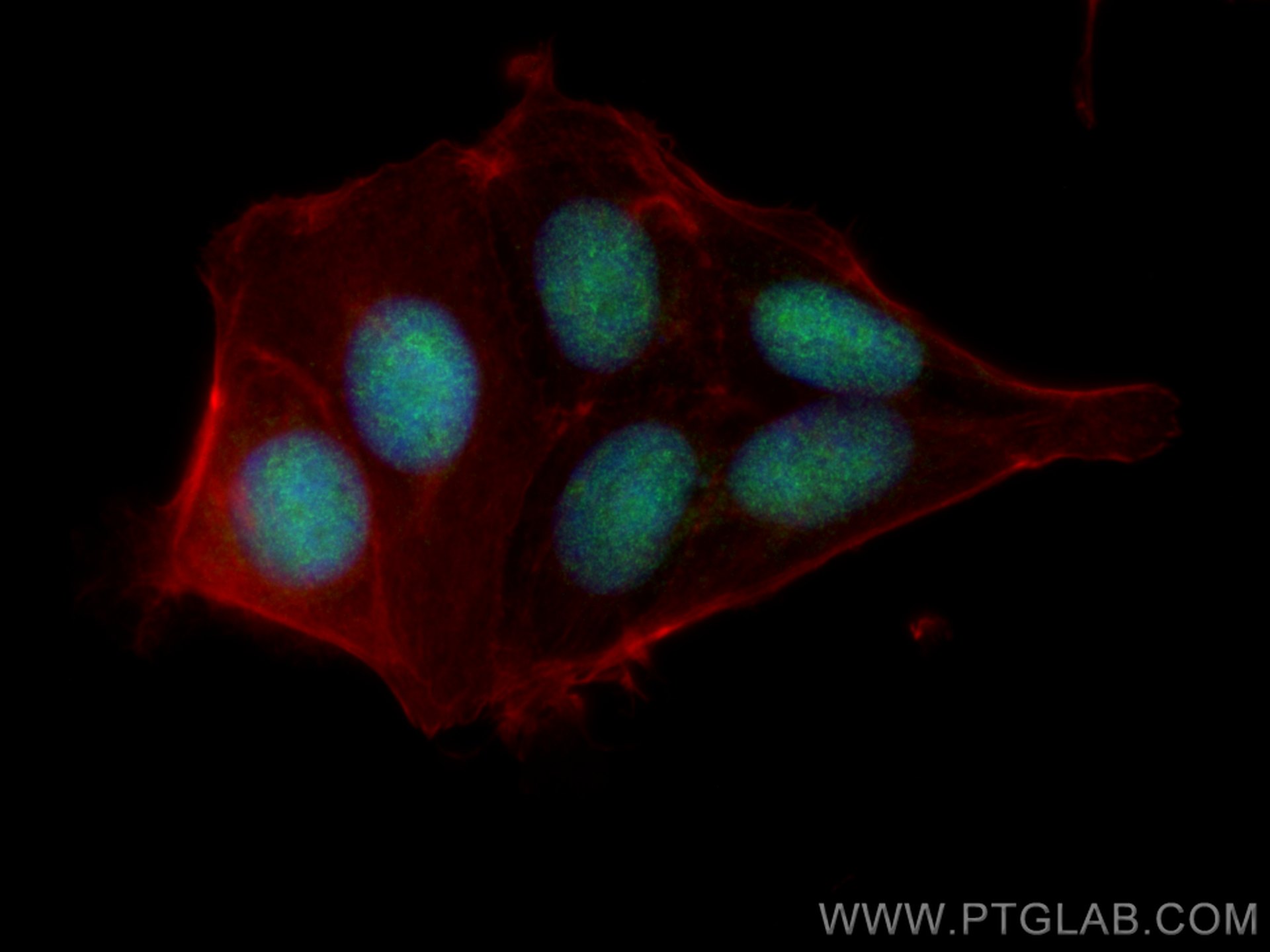 IF Staining of MCF-7 using 13314-1-AP