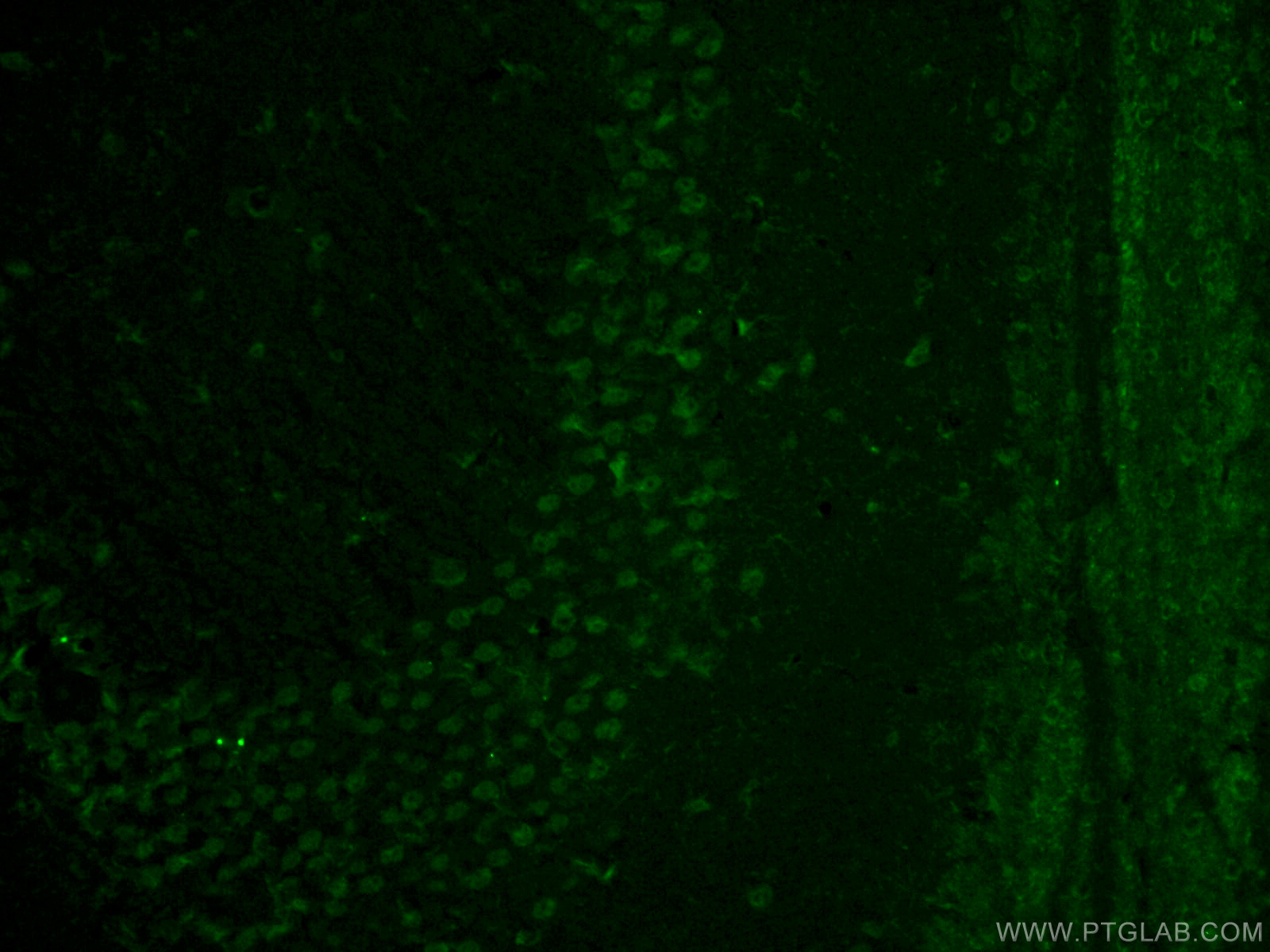 IF Staining of mouse brain using 10690-1-AP