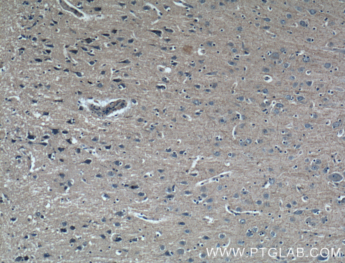 IHC staining of human brain using 60062-1-Ig (same clone as 60062-1-PBS)