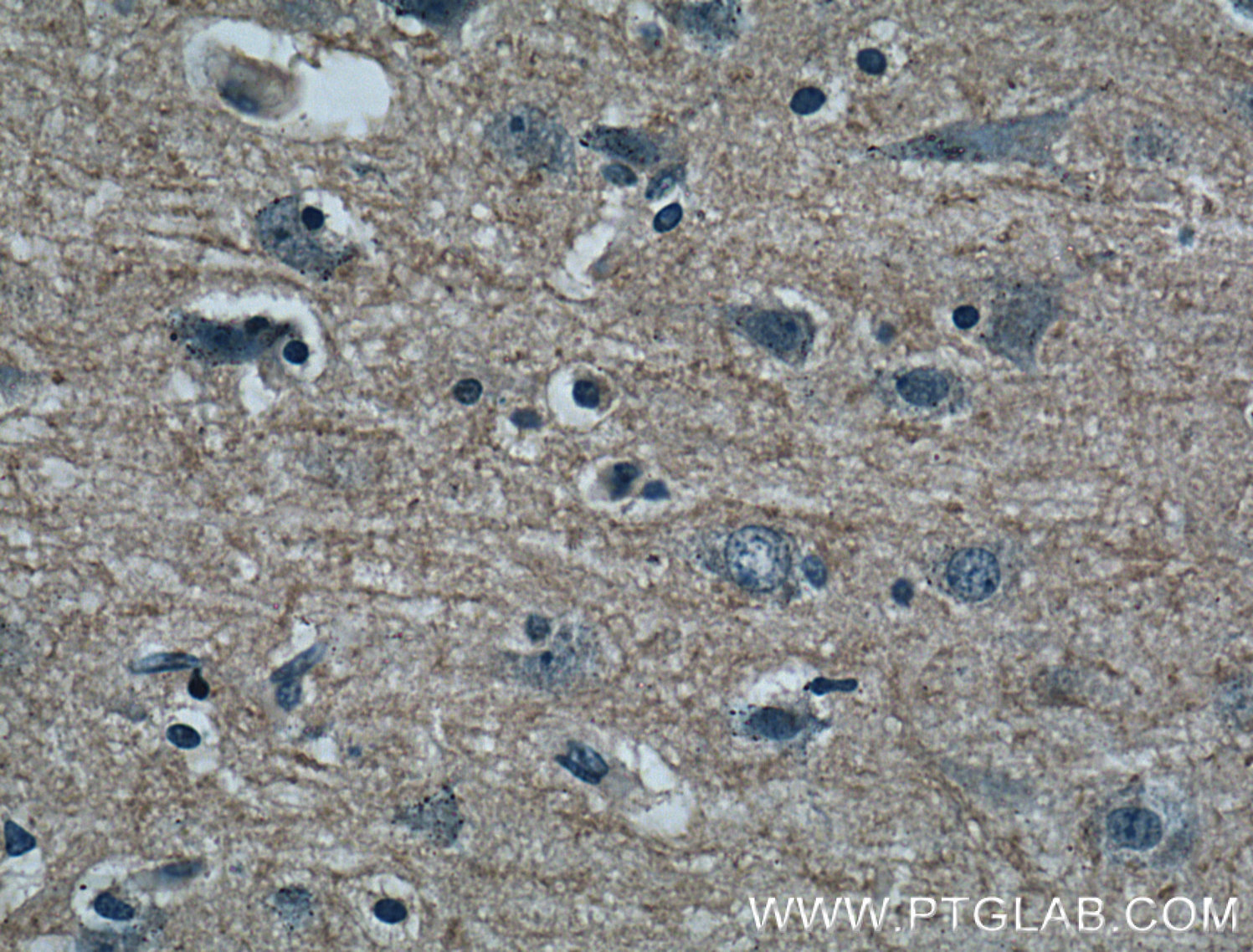 IHC staining of human brain using 60062-1-Ig (same clone as 60062-1-PBS)