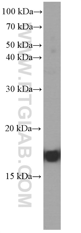 WB analysis of fetal human brain using 60062-1-Ig (same clone as 60062-1-PBS)