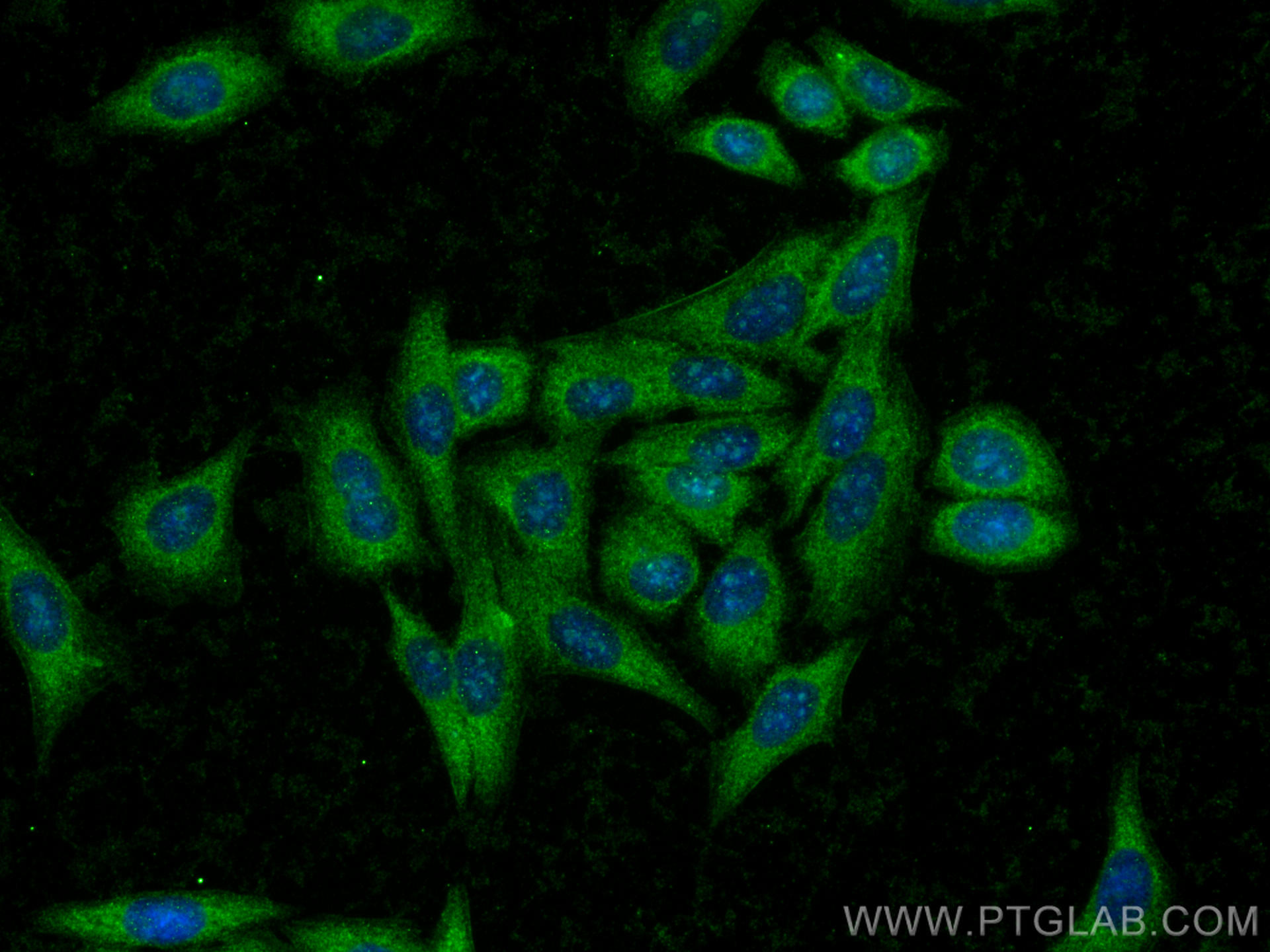 IF Staining of HepG2 using 25917-1-AP