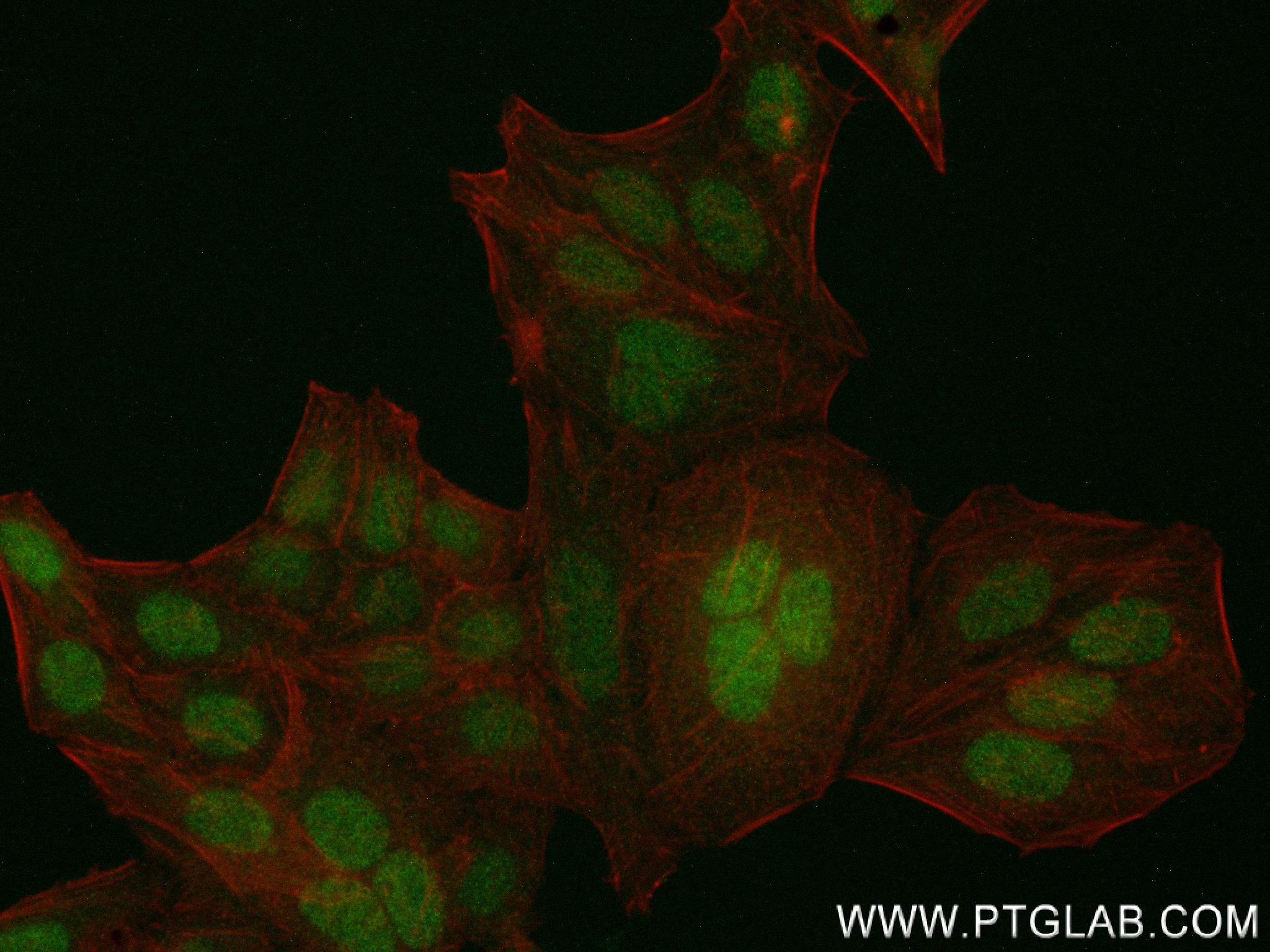 IF Staining of HepG2 using 84199-1-RR