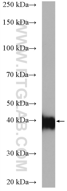 WB analysis of mouse skeletal muscle using 15094-1-AP