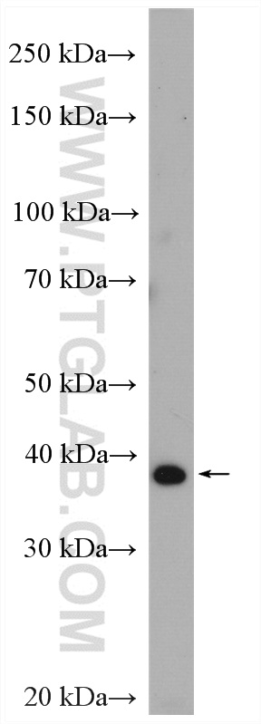 WB analysis of rat brain using 15094-1-AP