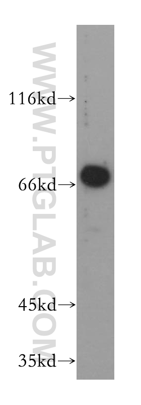 WB analysis of HeLa using 16376-1-AP