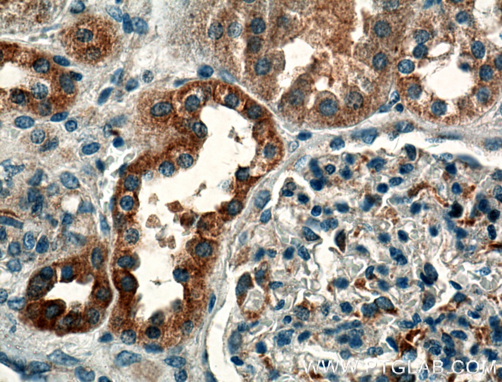 IHC staining of human kidney using 13350-1-AP