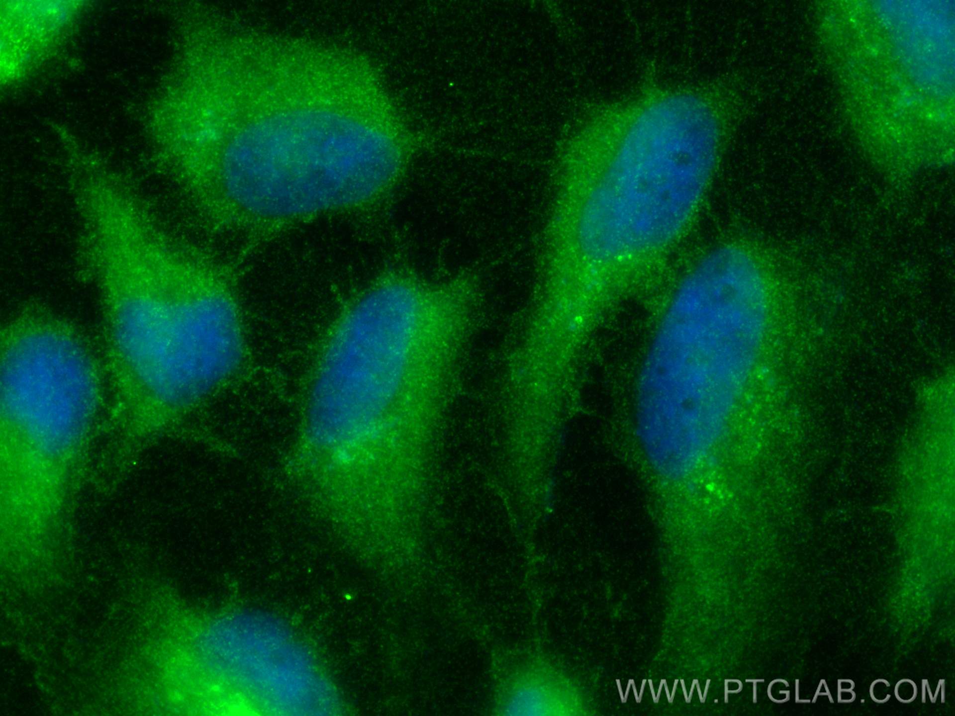 IF Staining of HeLa using 11641-1-AP