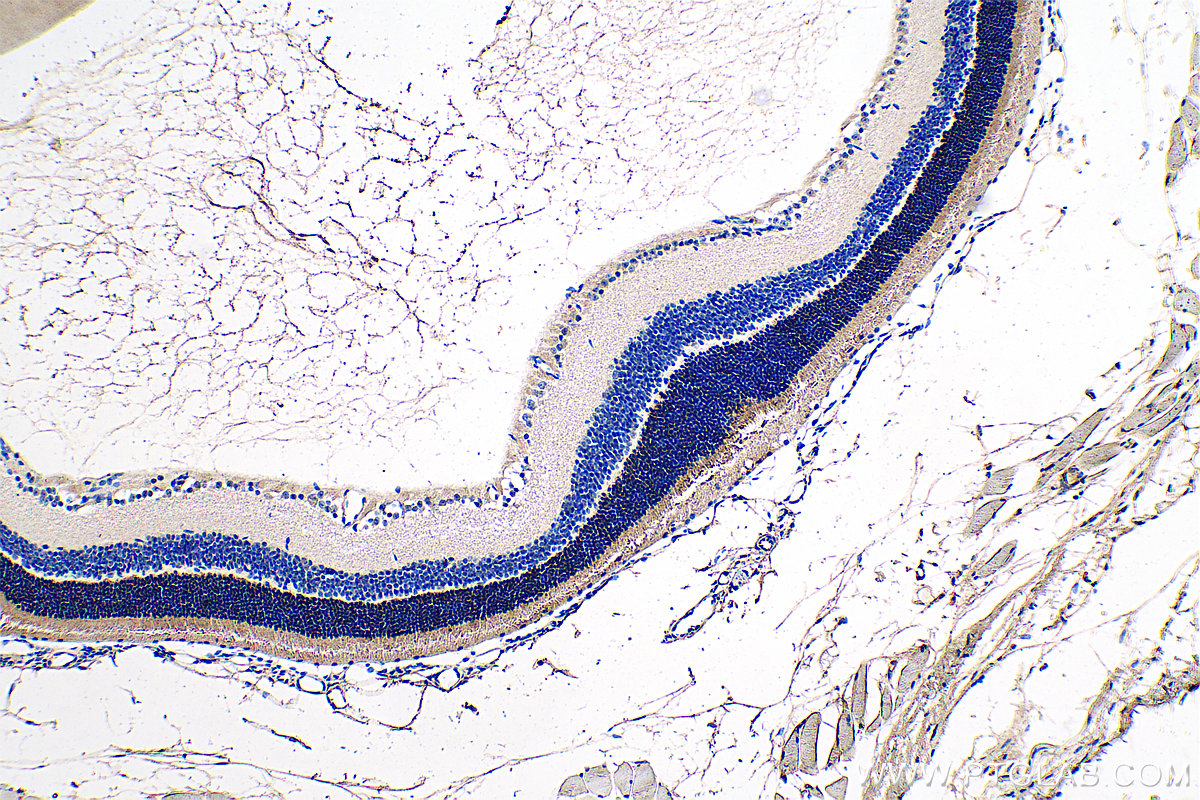 IHC staining of mouse eye using 55167-1-AP