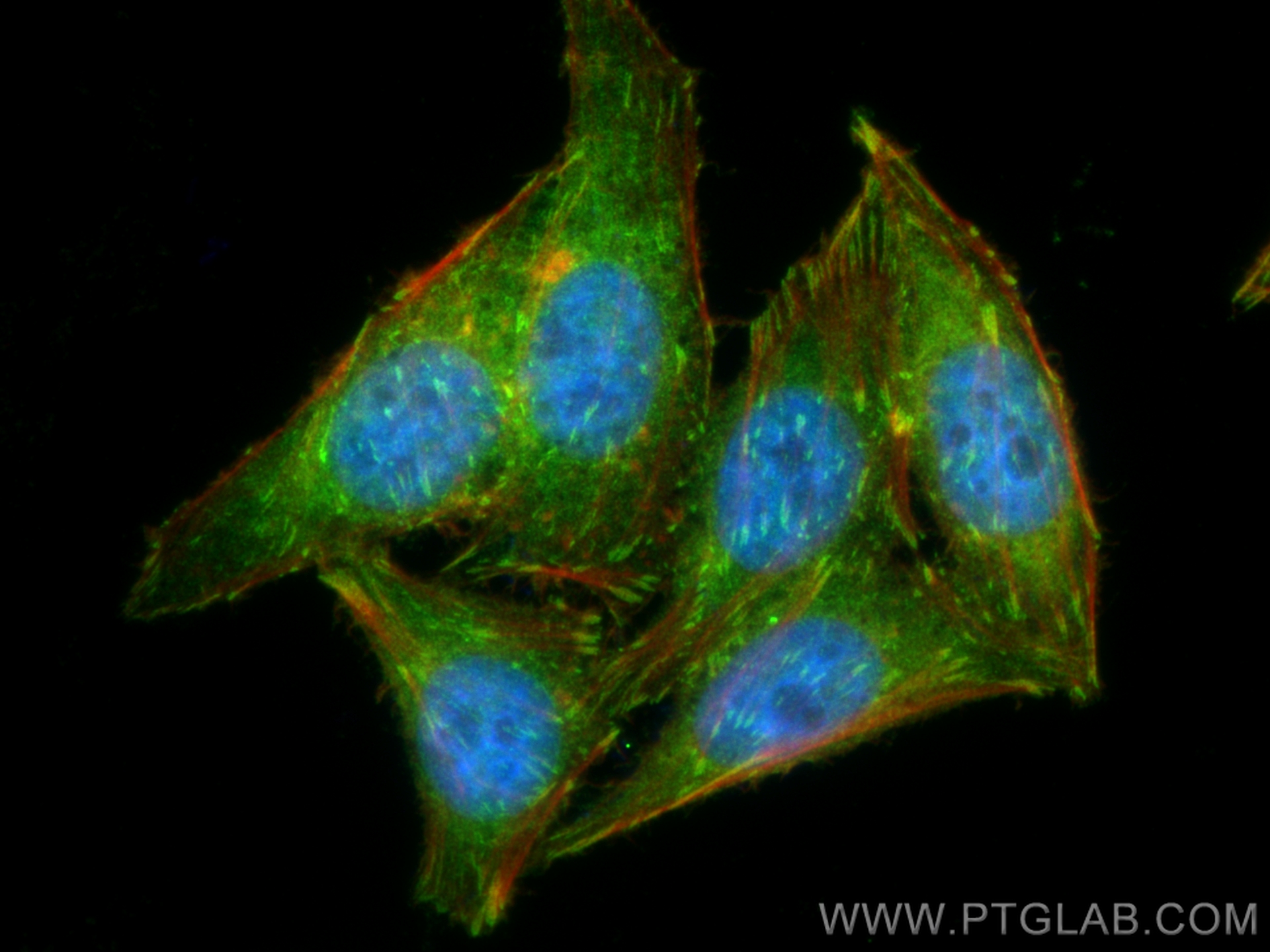 IF Staining of HepG2 using 10247-2-AP