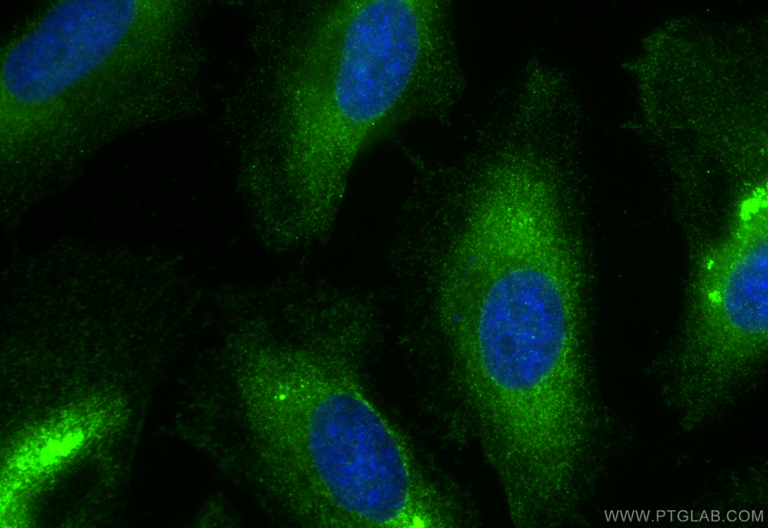 IF Staining of HeLa using 16090-1-AP