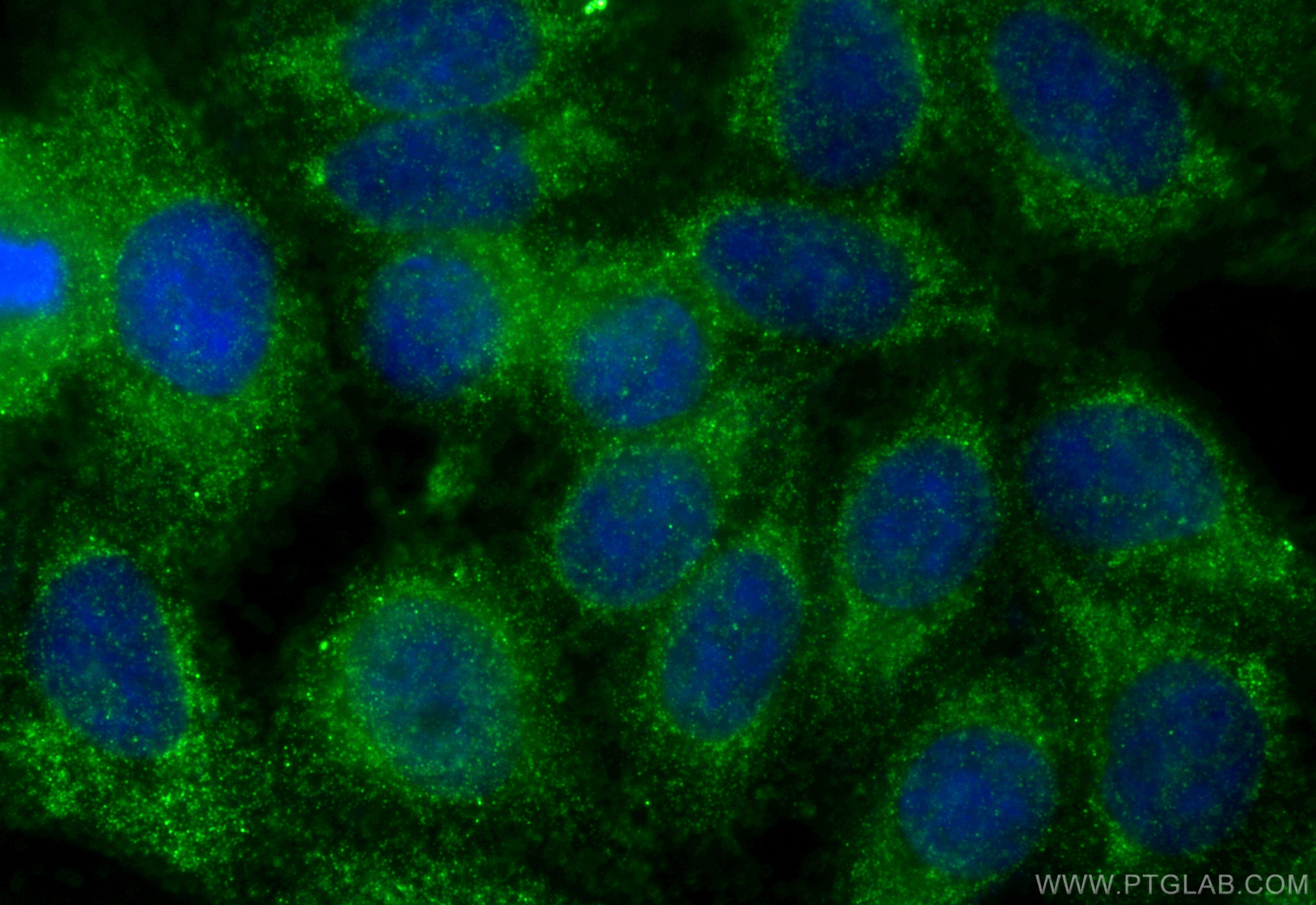 IF Staining of HepG2 using 10081-1-AP