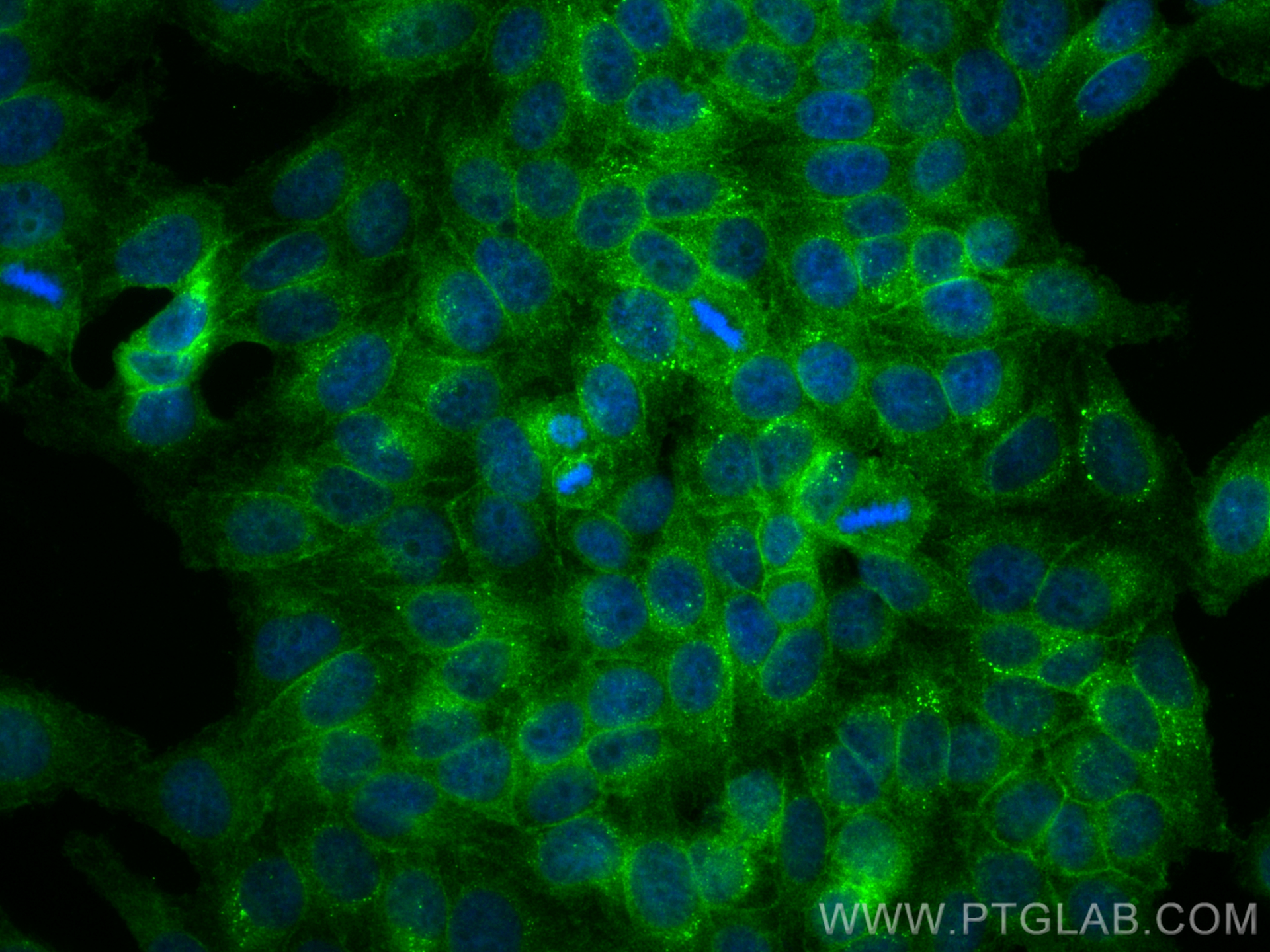 IF Staining of HepG2 using 11978-2-AP (same clone as 11978-2-PBS)