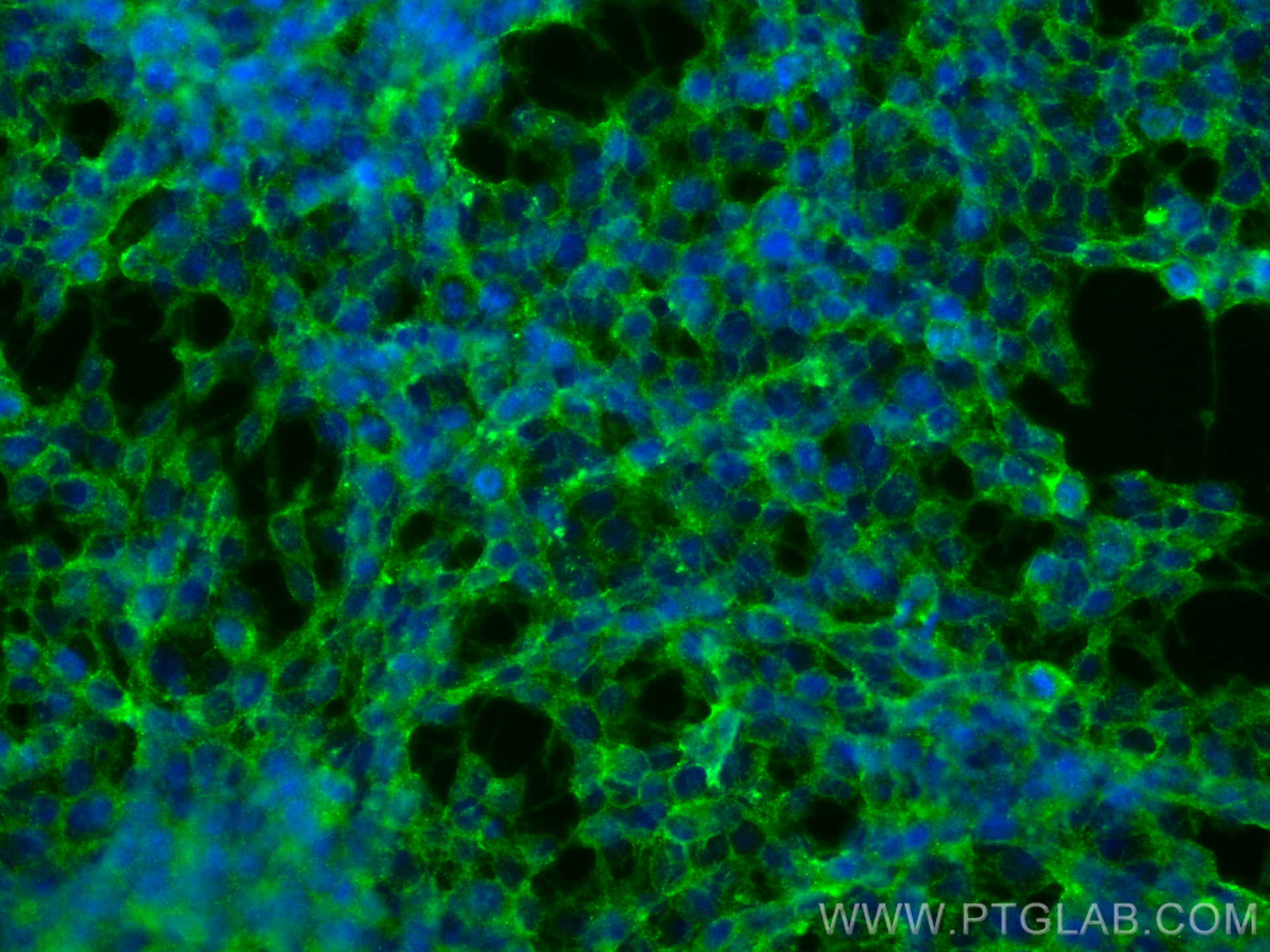 IF Staining of SH-SY5Y using 11978-2-AP (same clone as 11978-2-PBS)