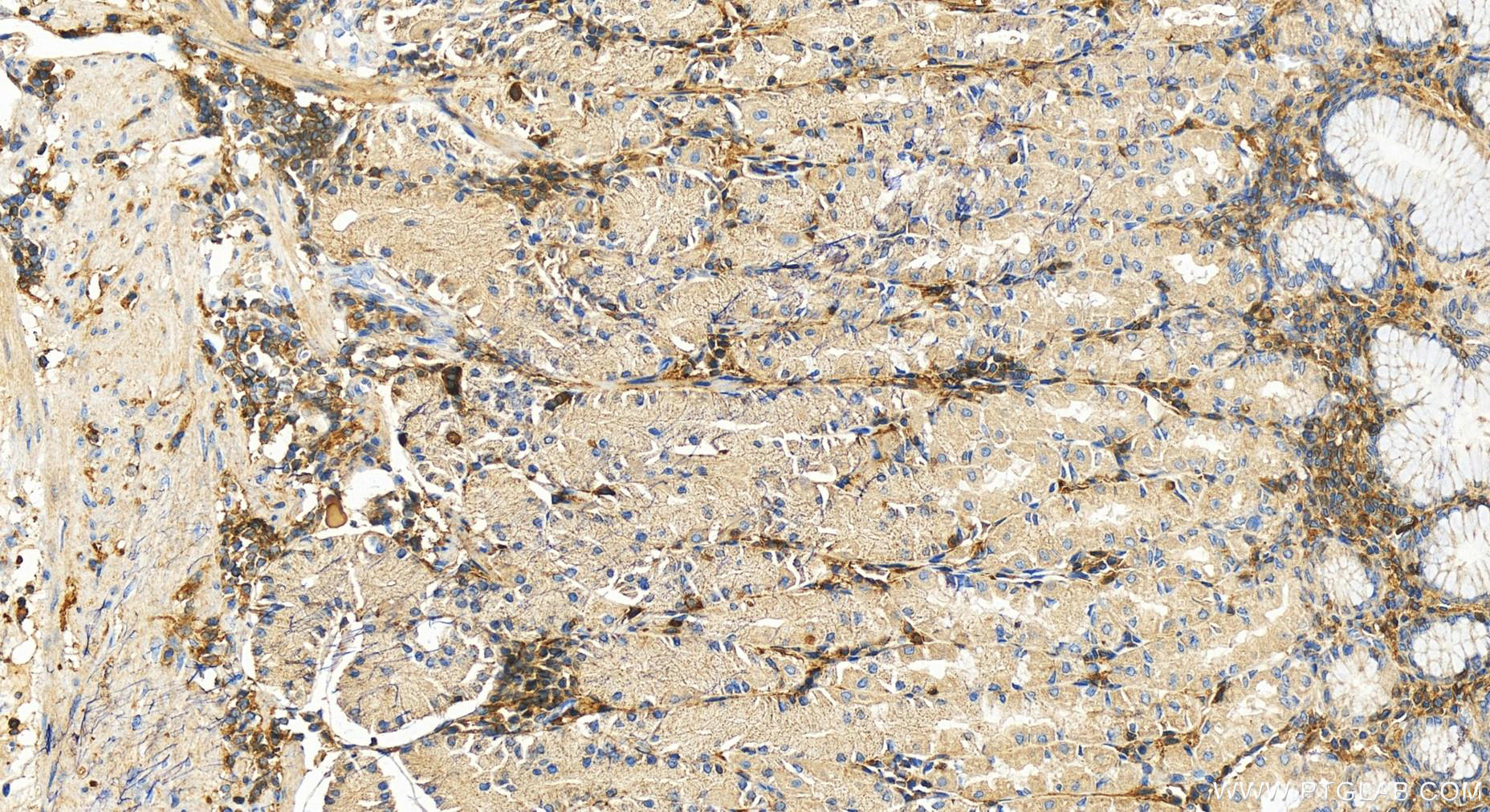 IHC staining of human stomach using 11693-1-AP