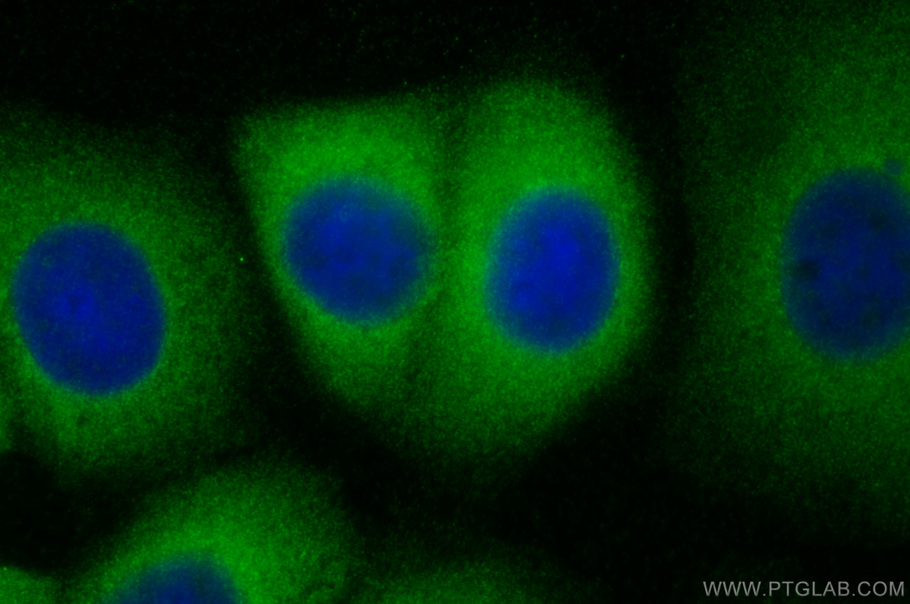 IF Staining of MCF-7 using 14078-1-AP