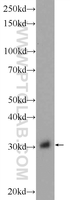 WB analysis of rat kidney using 17105-1-AP