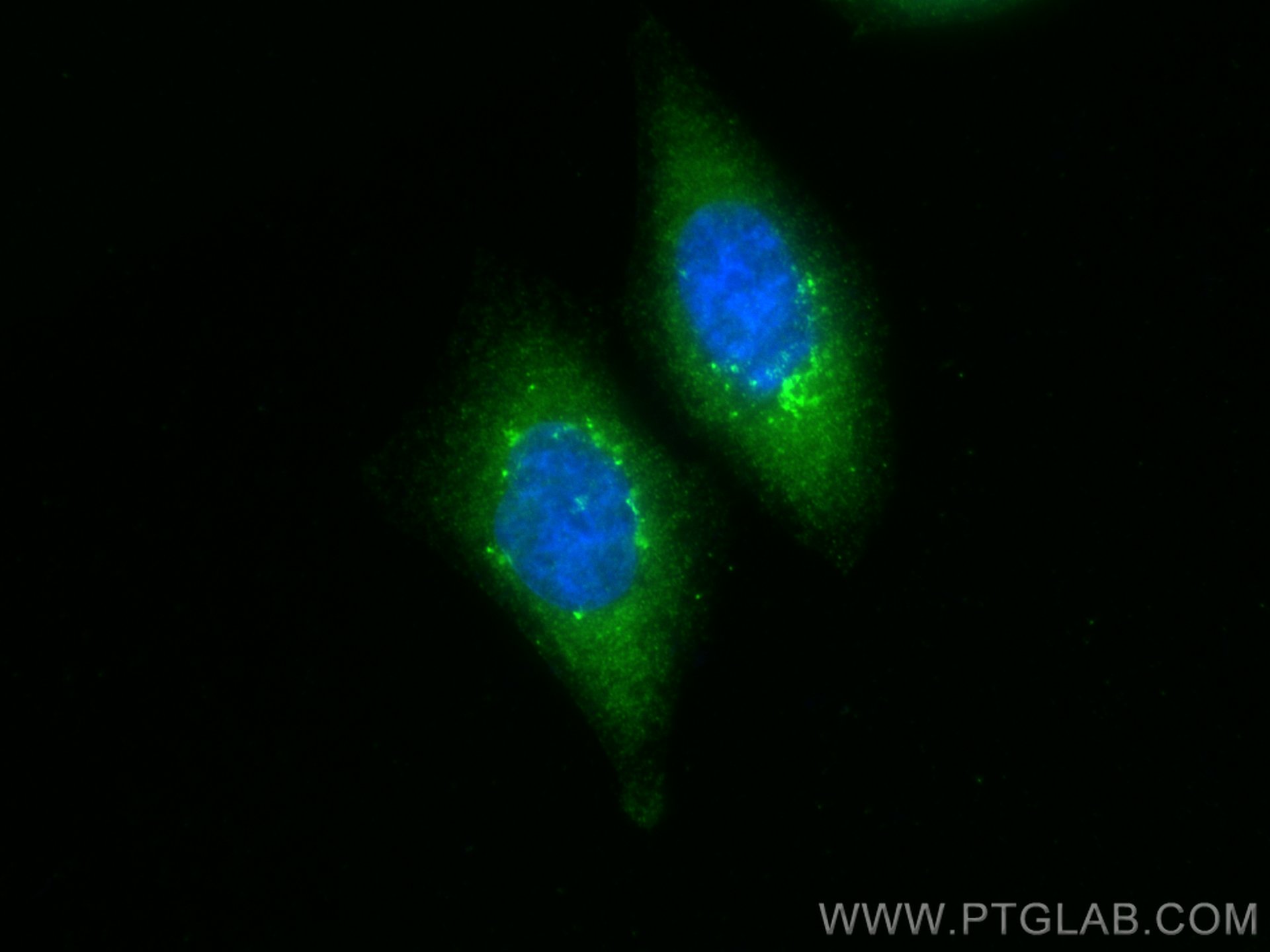 IF Staining of HepG2 using 21193-1-AP