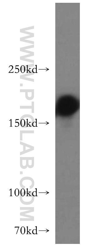 WB analysis of L02 using 21193-1-AP