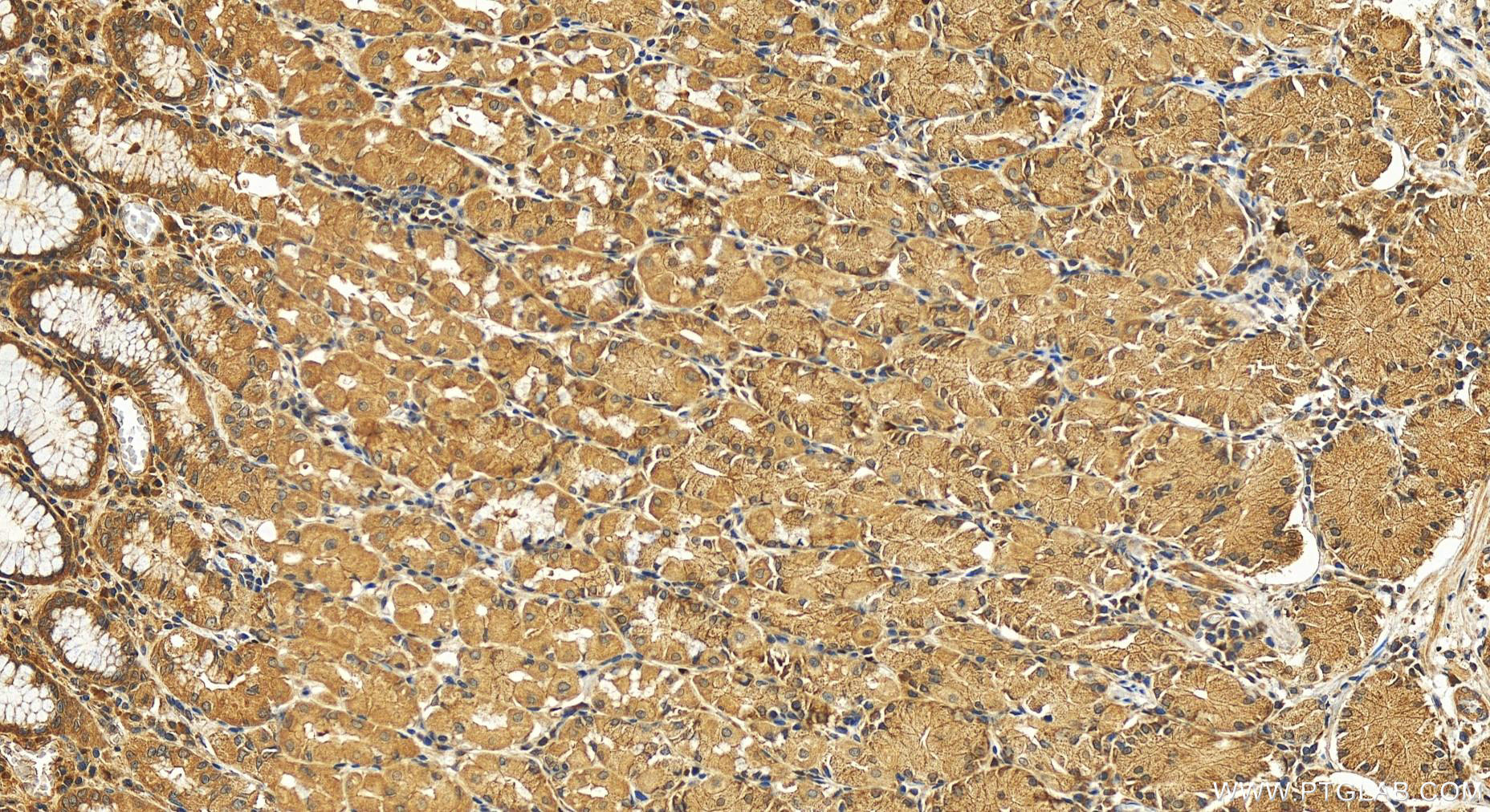 IHC staining of human stomach using 12095-1-AP