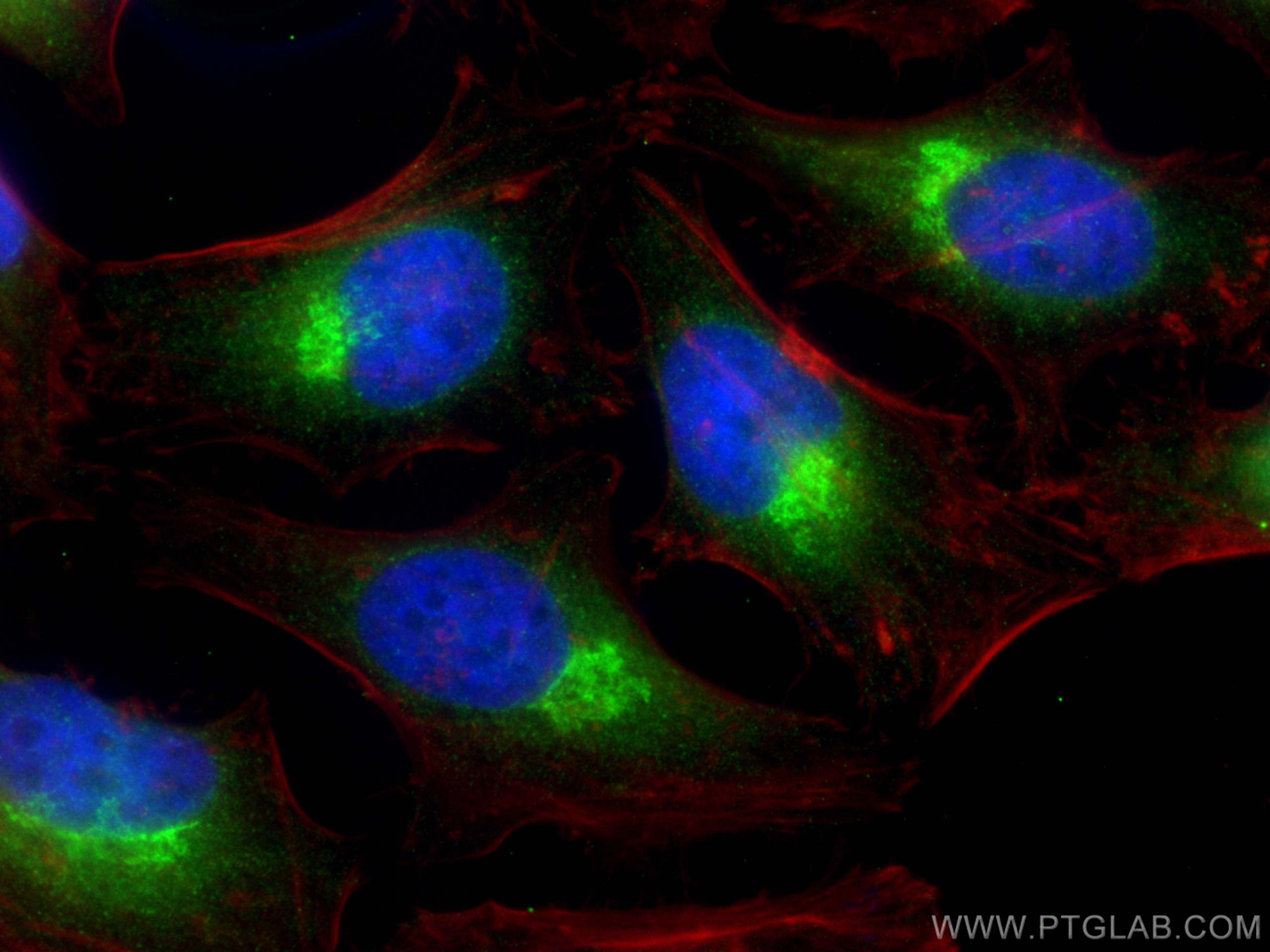 IF Staining of HeLa using 12095-1-AP