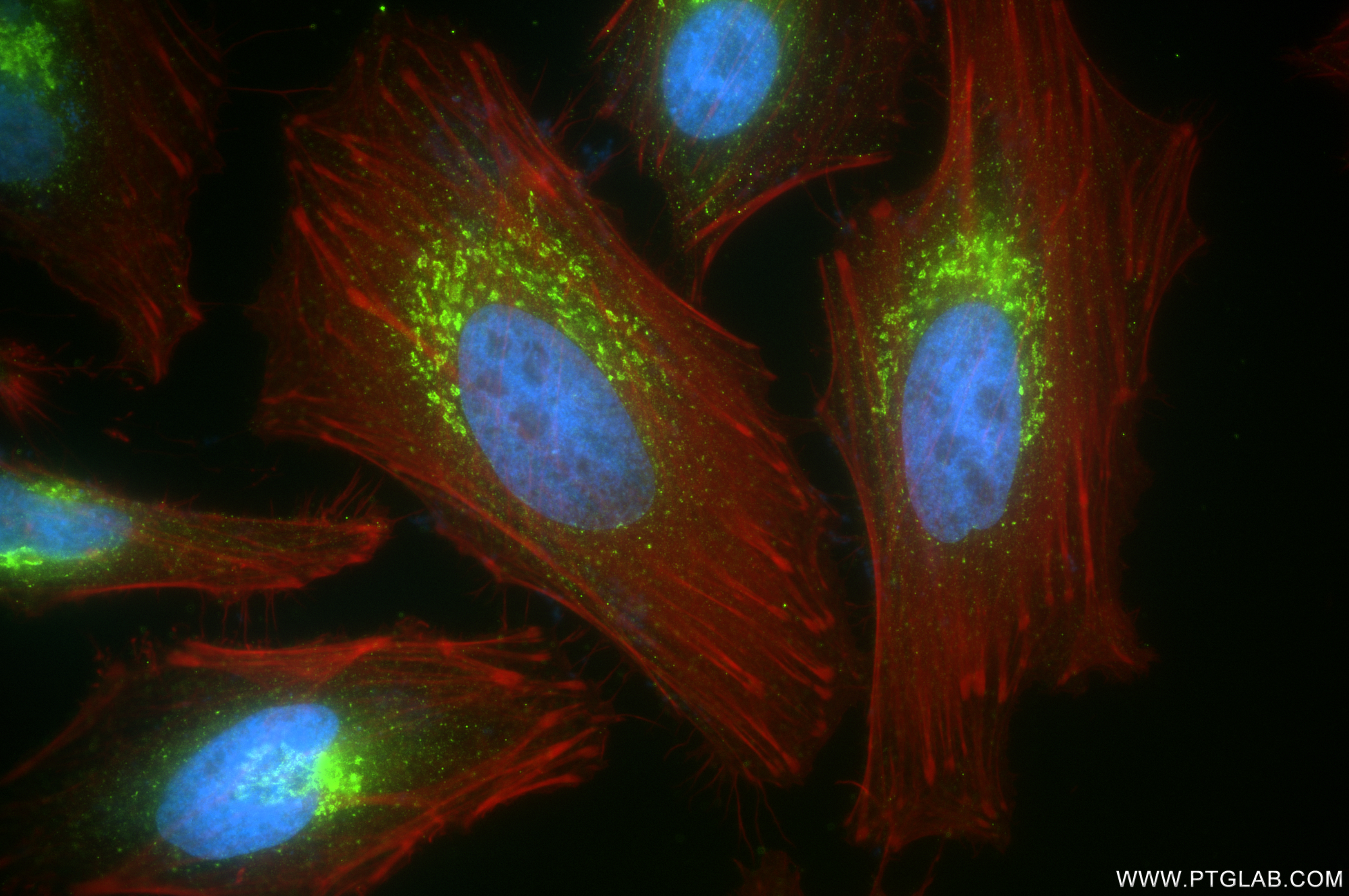 IF Staining of HeLa using 84962-4-RR (same clone as 84962-4-PBS)