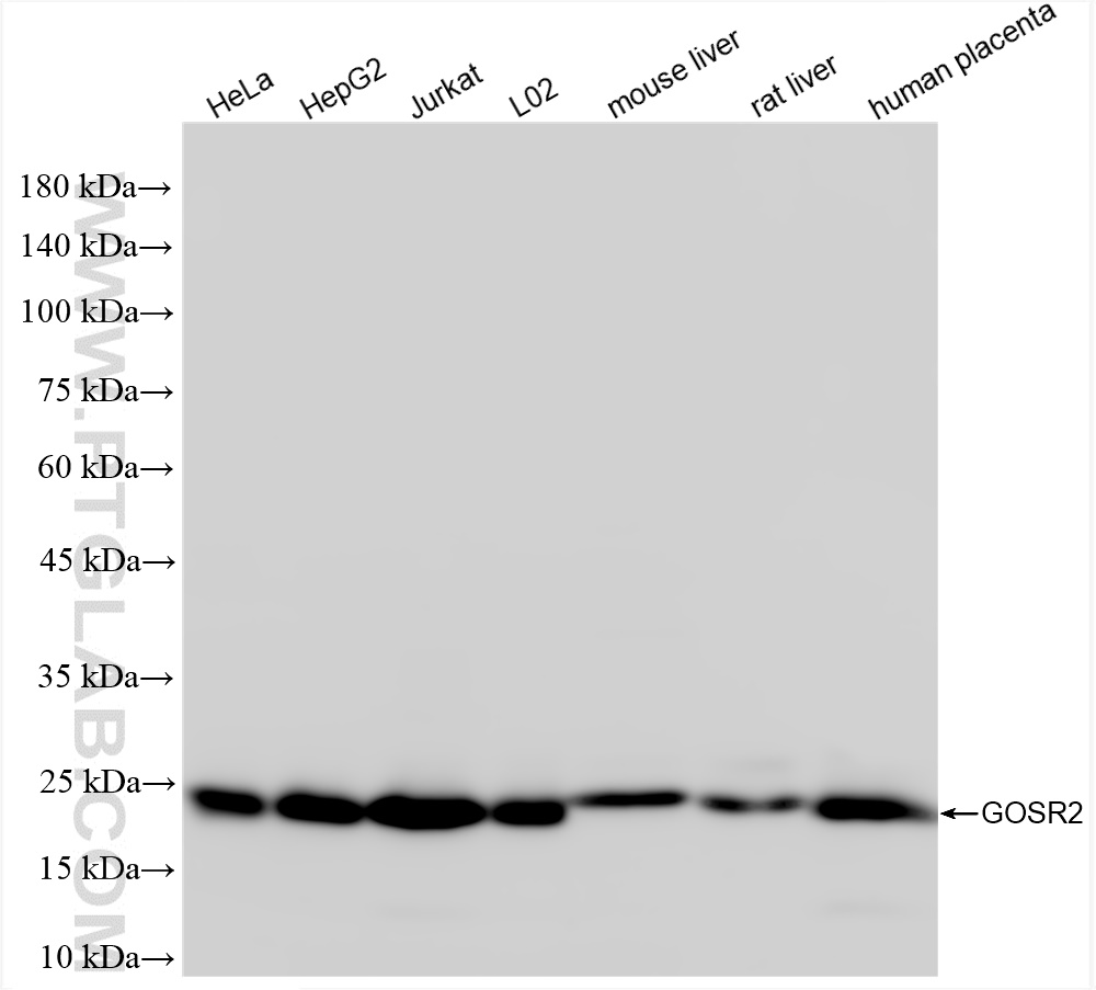 GOSR2/Membrin