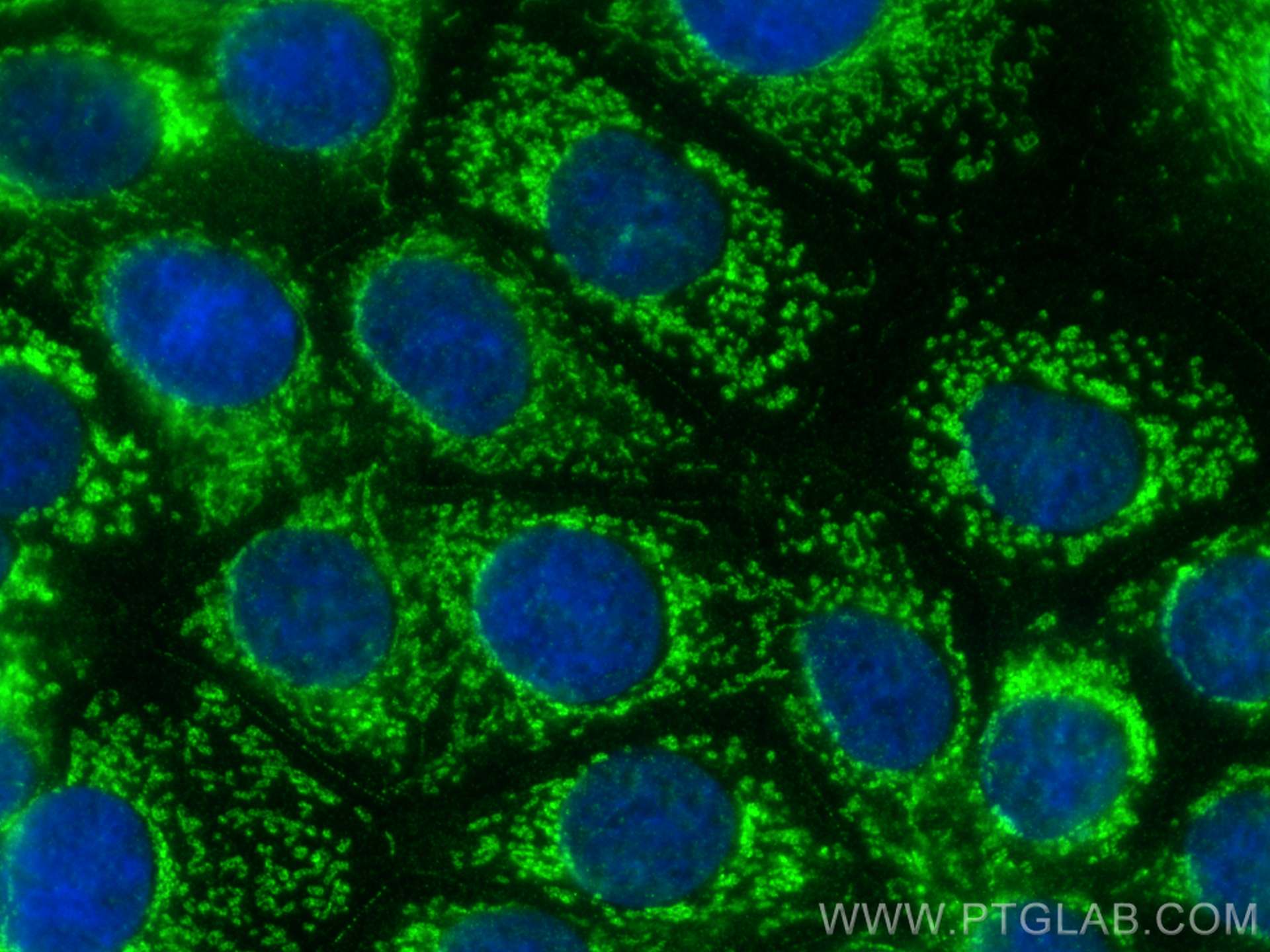 IF Staining of MCF-7 using 14800-1-AP