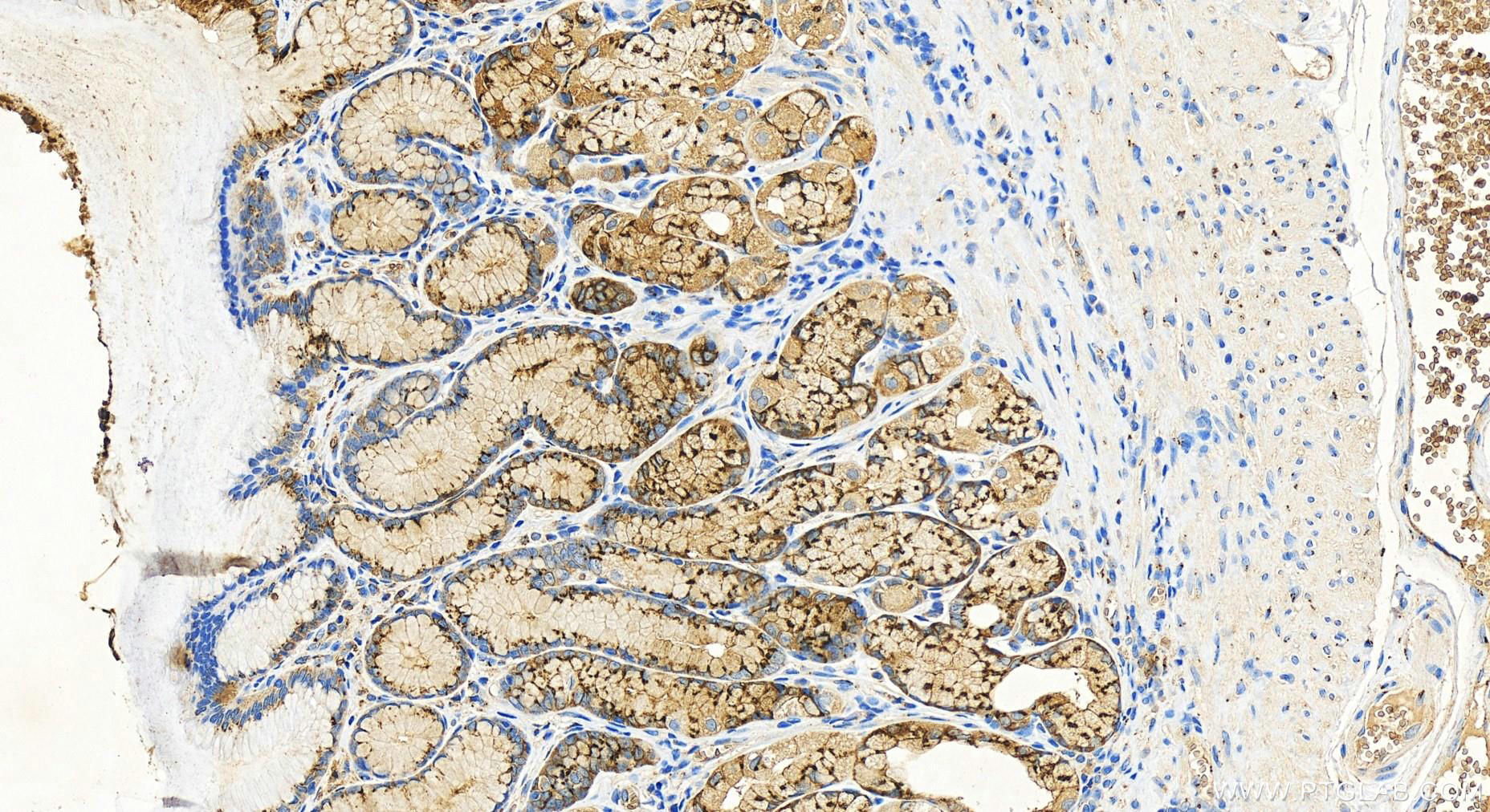 IHC staining of human stomach using 81893-1-RR