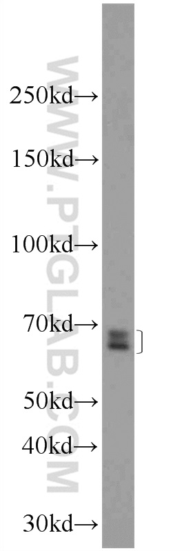 WB analysis of mouse spleen using 24366-1-AP