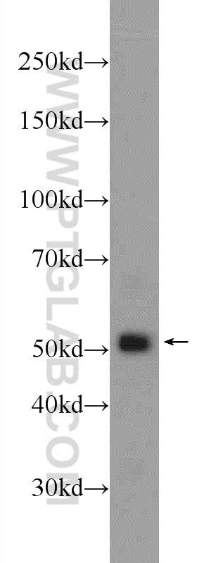 WB analysis of HEK-293 using 24399-1-AP