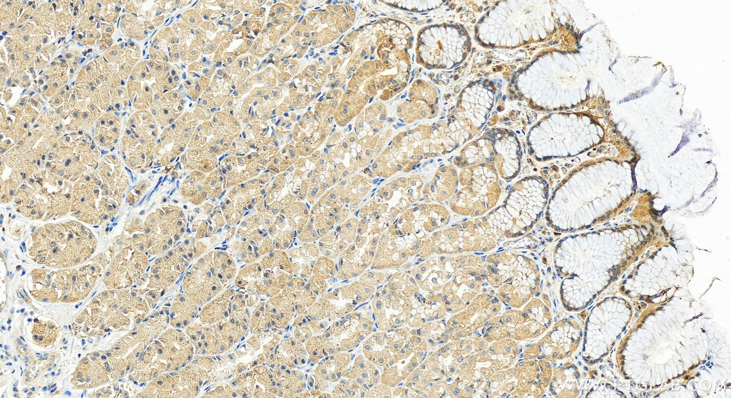 IHC staining of human stomach using 13048-1-AP