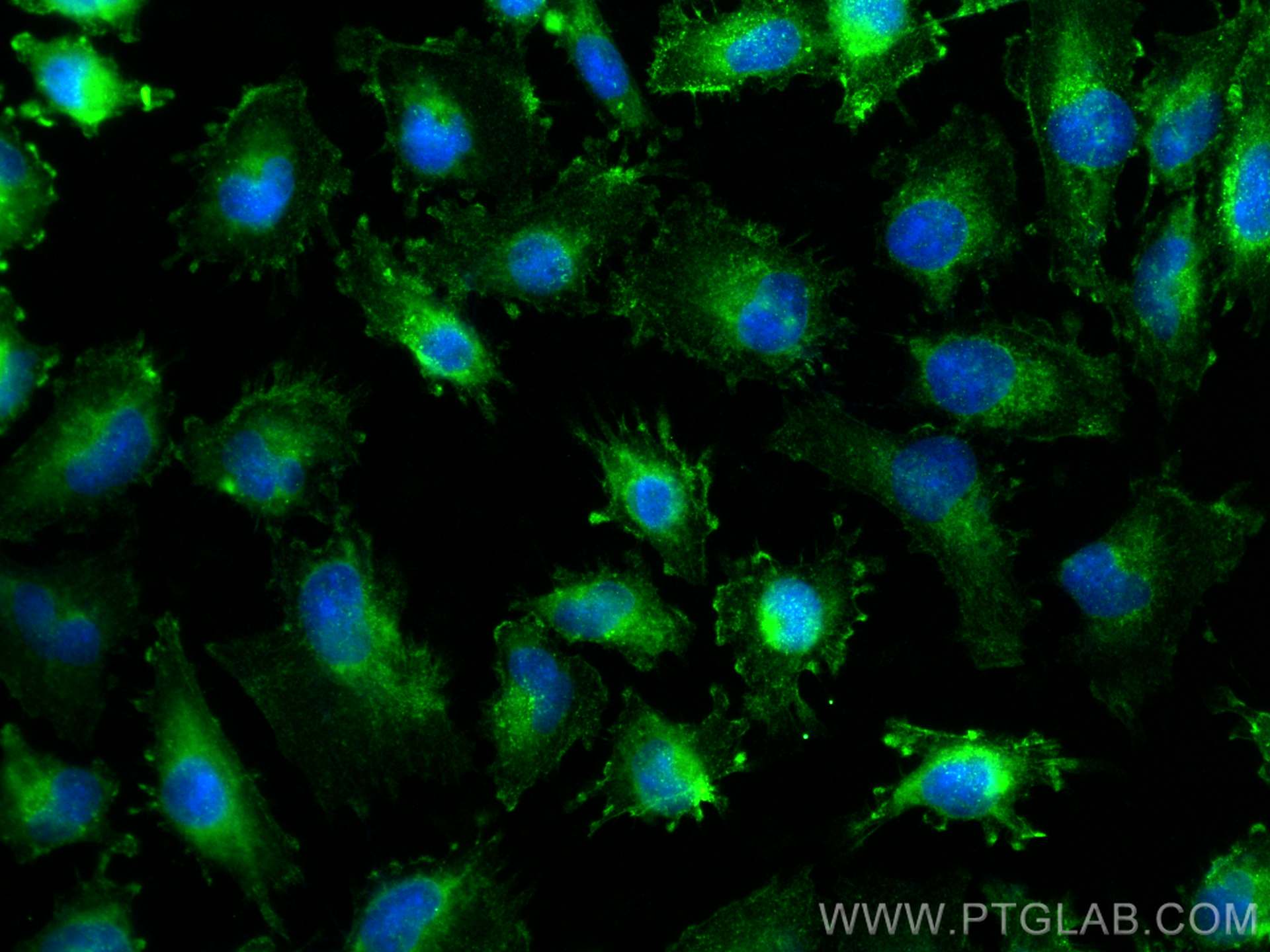 IF Staining of U-251 using 13048-1-AP