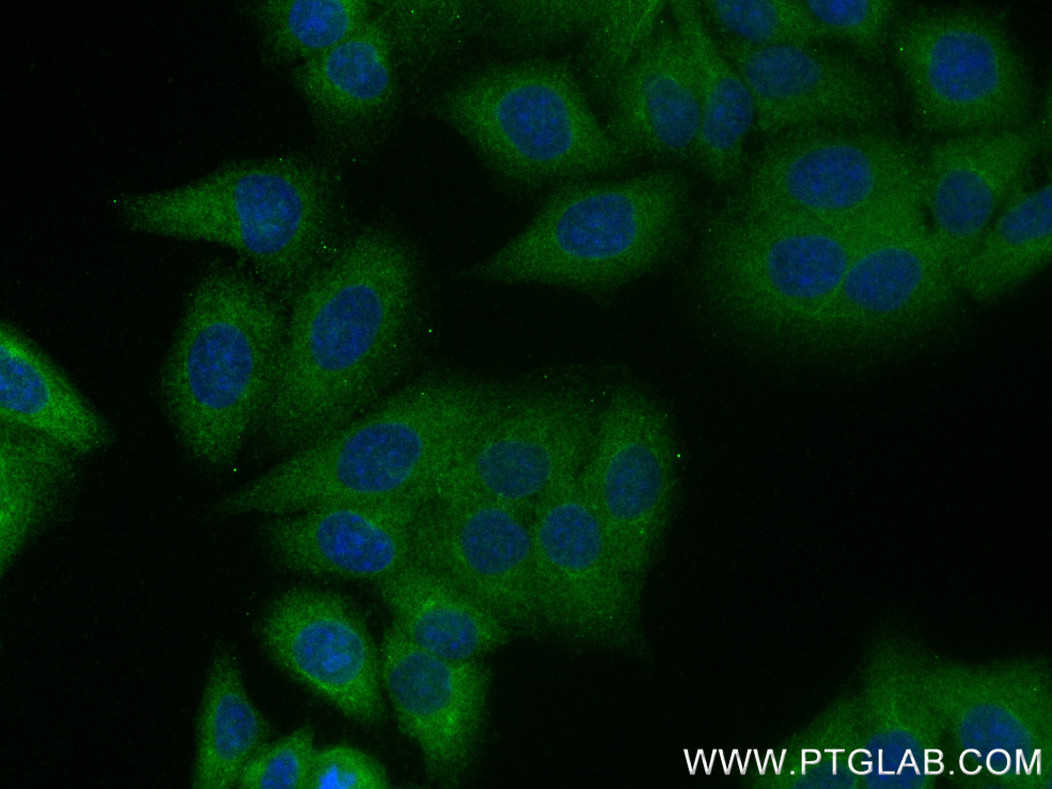 IF Staining of HepG2 using 84800-1-RR (same clone as 84800-1-PBS)