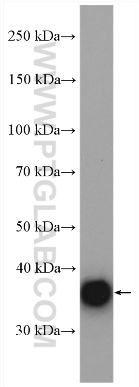 WB analysis of mouse heart using 17263-1-AP