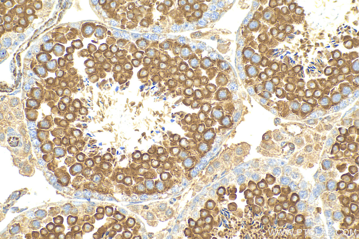 IHC staining of mouse testis using 17219-1-AP