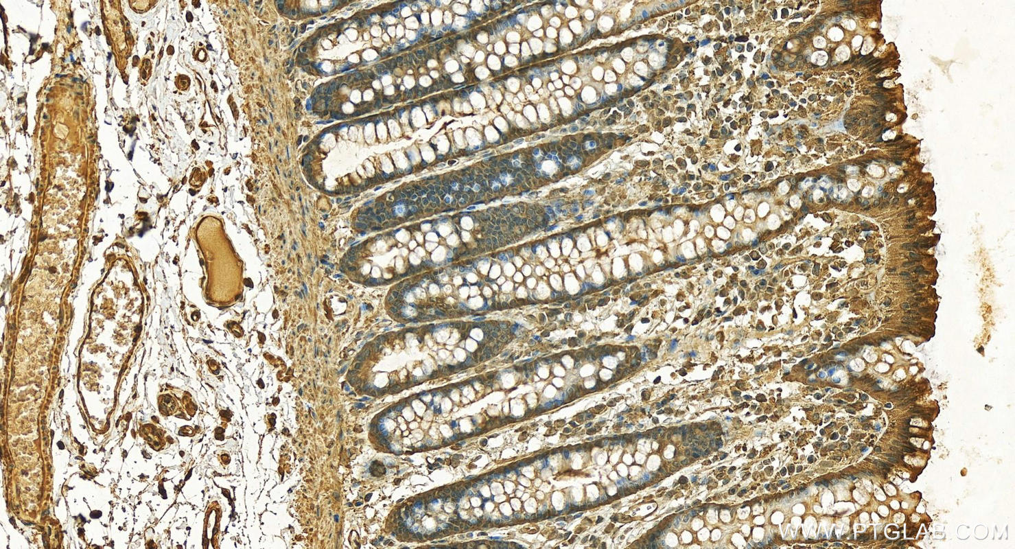 IHC staining of human colon using 15171-1-AP