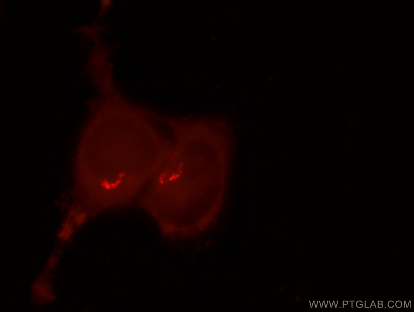 IF Staining of HEK-293 using 25076-1-AP