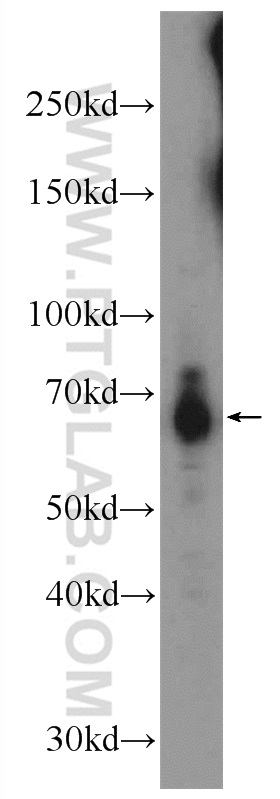 WB analysis of mouse kidney using 24009-1-AP