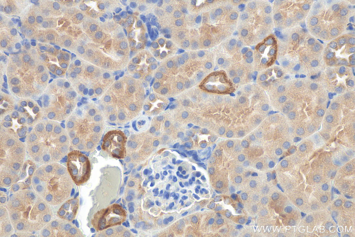 IHC staining of mouse kidney using 81632-1-RR (same clone as 81632-1-PBS)