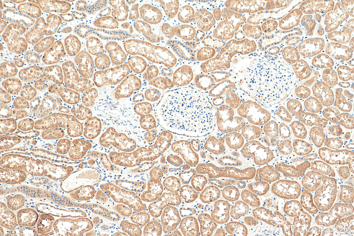 IHC staining of human kidney using 16496-1-AP