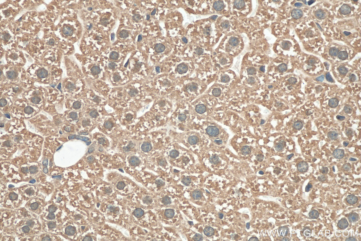 IHC staining of mouse liver using 29934-1-AP