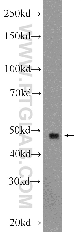 WB analysis of mouse heart using 19951-1-AP